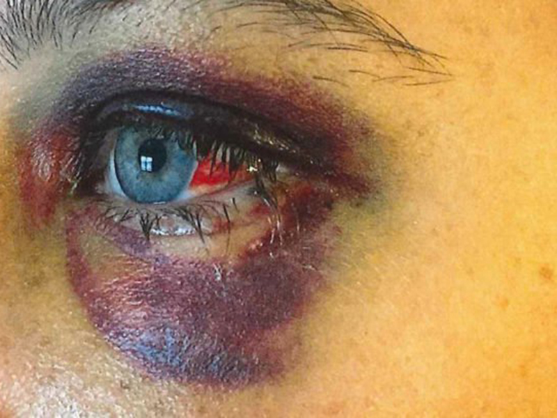 اضغط لمشاهدة الفيديو: مشادة كلامية تنتهي باعتداء فتاتين بطريقة وحشية على امرأة!